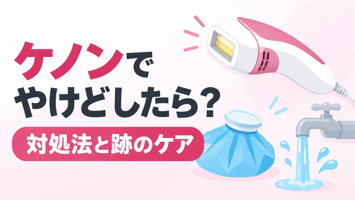 やけどの対処法と跡のケアを表した、光美容器と保冷剤、水道の蛇口のイラスト