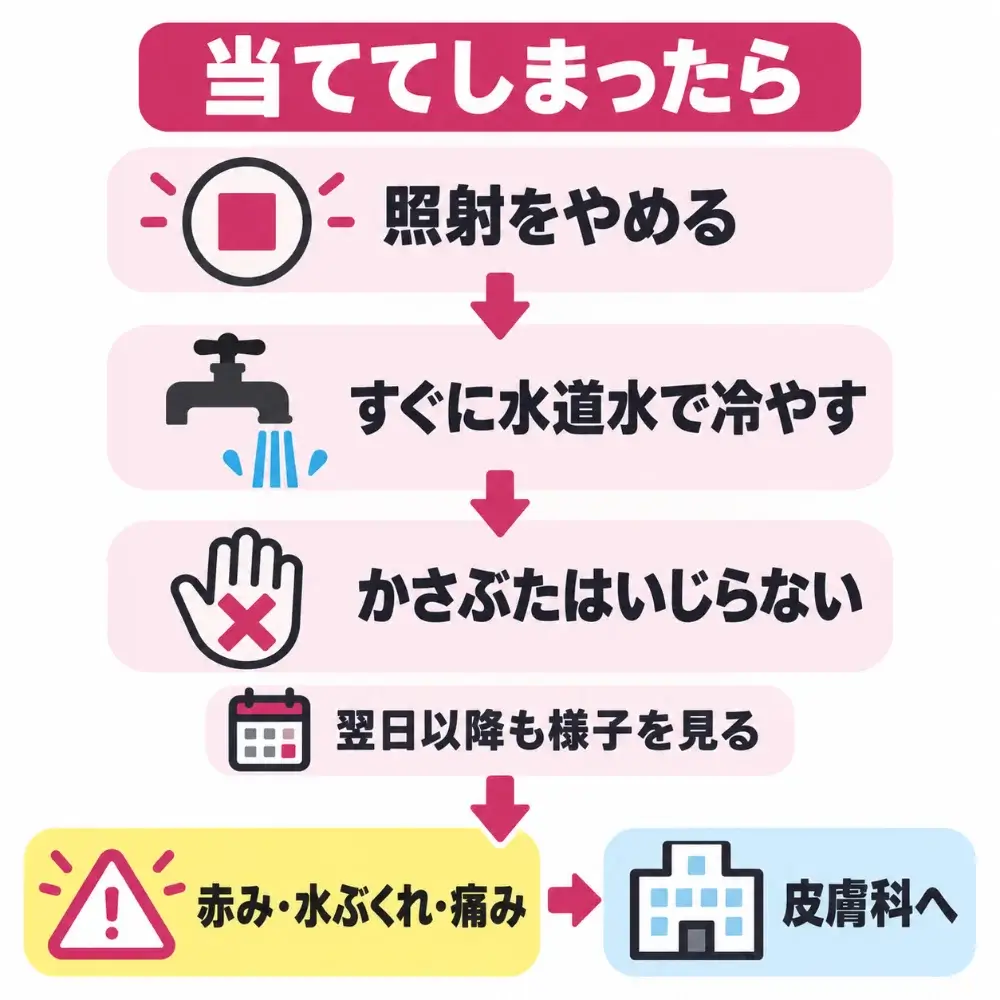 うっかりほくろに当ててしまったときの対処の流れ。照射をやめて、すぐに水道水で冷やし、かさぶたはいじらない。赤み・水ぶくれ・痛みが続くなら皮膚科へ