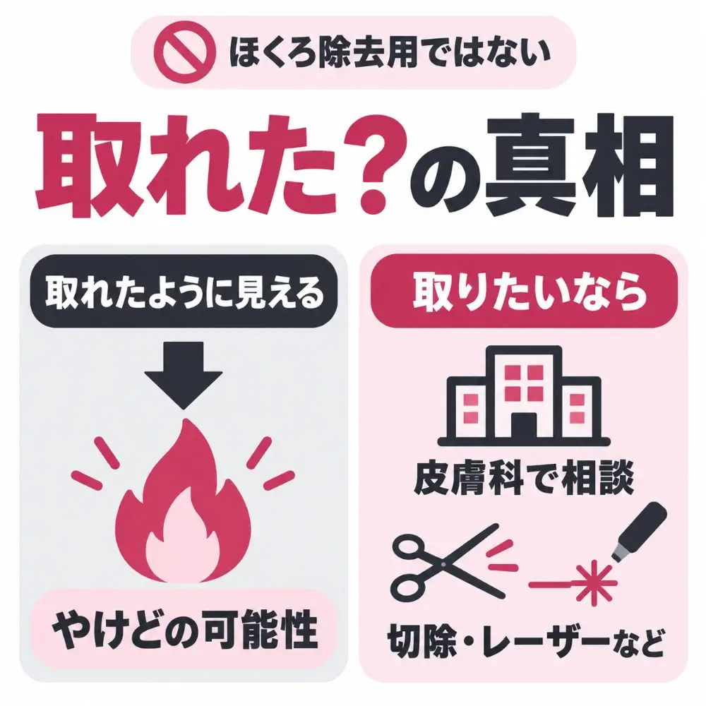 ケノンでほくろが取れたように見えるのは、やけどでかさぶたになった可能性がある。ほくろを取りたいなら、皮膚科で切除やレーザーなどの方法を相談する