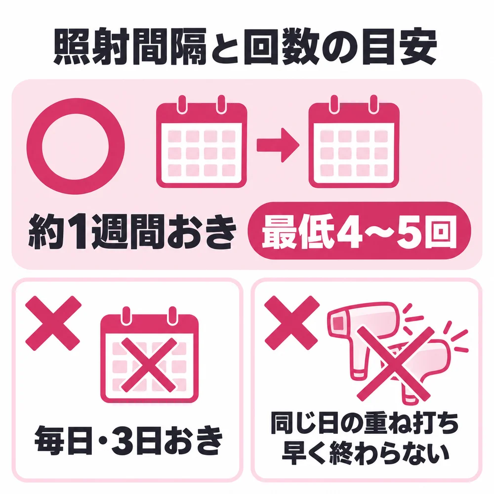 ケノンのVIO脱毛の照射間隔と回数の目安。公式は約1週間おきに最低4〜5回で、毎日や3日おき、同じ日の重ね打ちでは早く終わらない